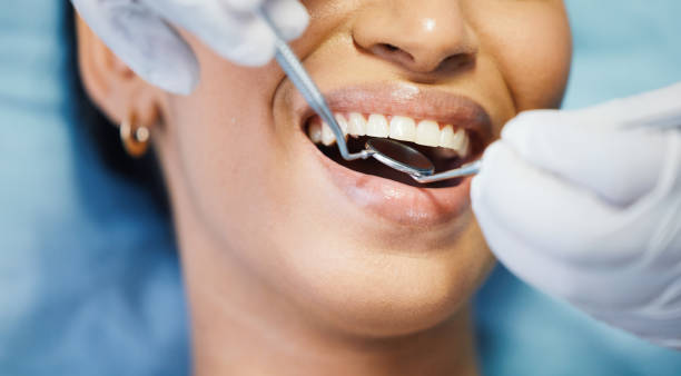 Best Pediatric Emergency Dentist in Platte City, MO