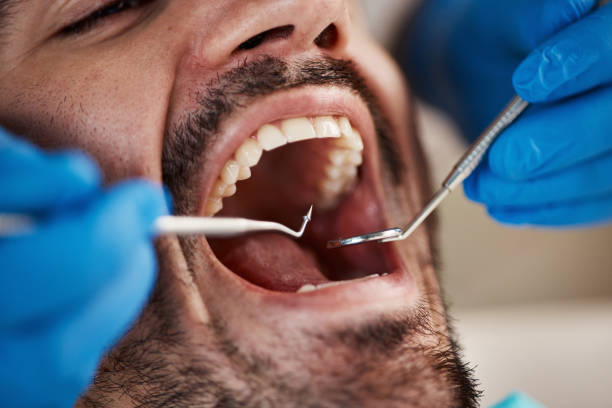 Best Emergency TMJ Treatment in Platte City, MO