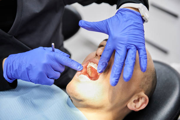 Best Emergency Dental Care for Broken or Chipped Teeth in Platte City, MO